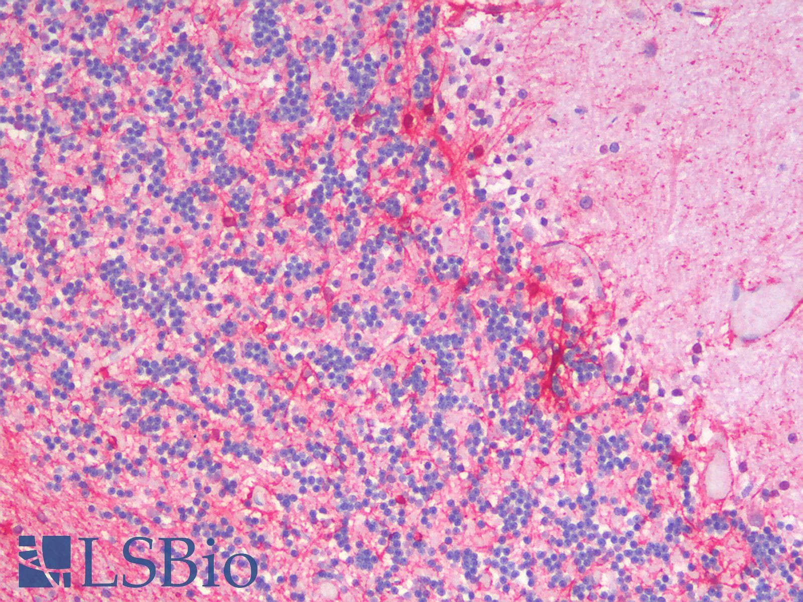 PathPlus™ Polyclonal Rabbit anti-Mouse GFAP Antibody (IHC, IF, WB)