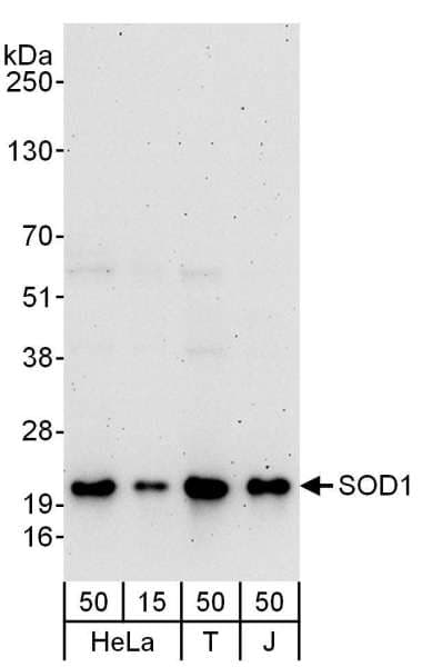 SOD1 / Cu-Zn SOD Antibody (aa104-154)