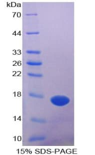 Human PTN / Pleiotrophin Protein (Recombinant His)