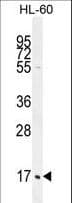 Polyclonal Rabbit anti-Human C1QG / Complement C1QC Antibody (aa93-120, IHC, IF, WB)
