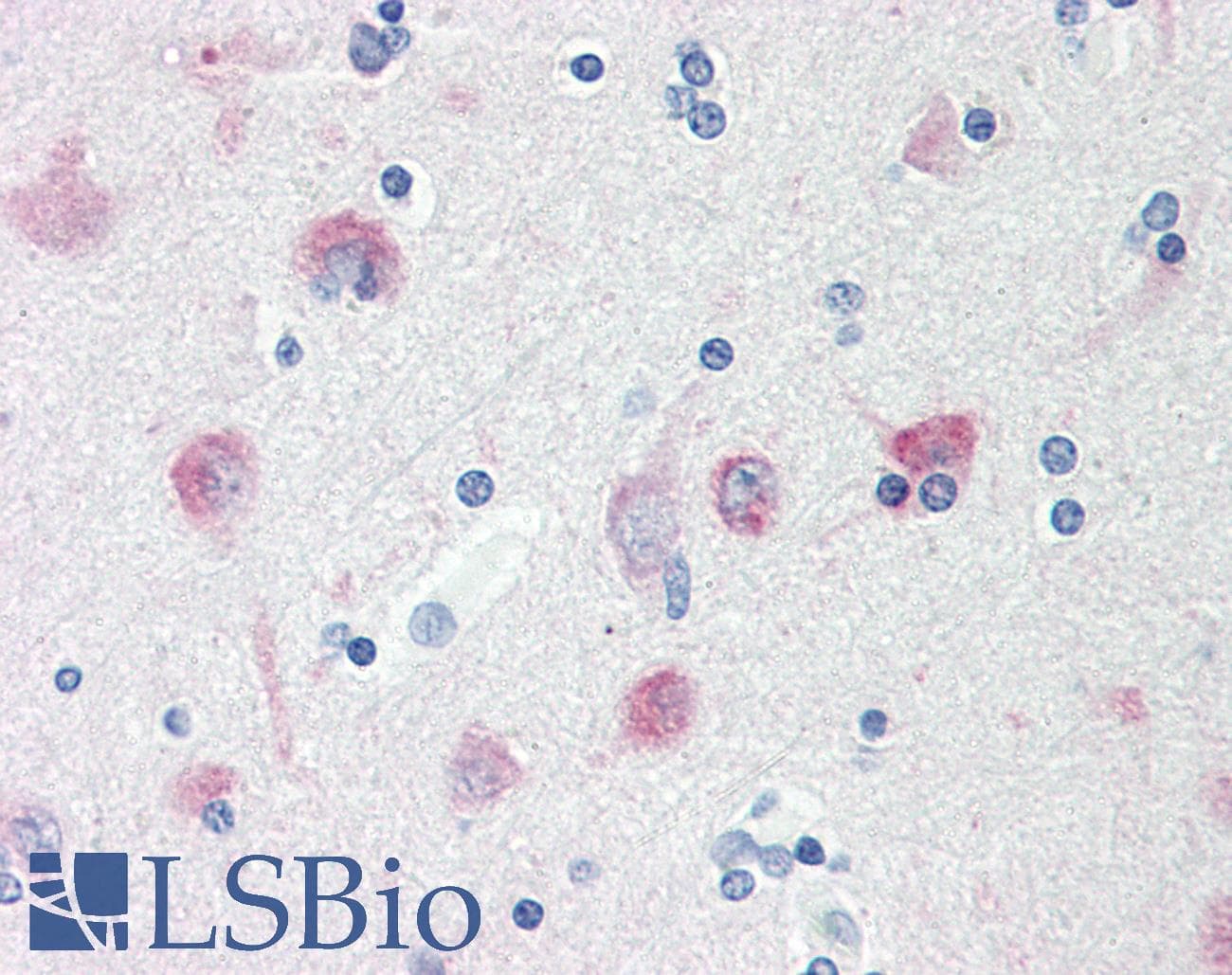 IHC-plus™ MAP1LC3B / LC3B Antibody (Thr6)