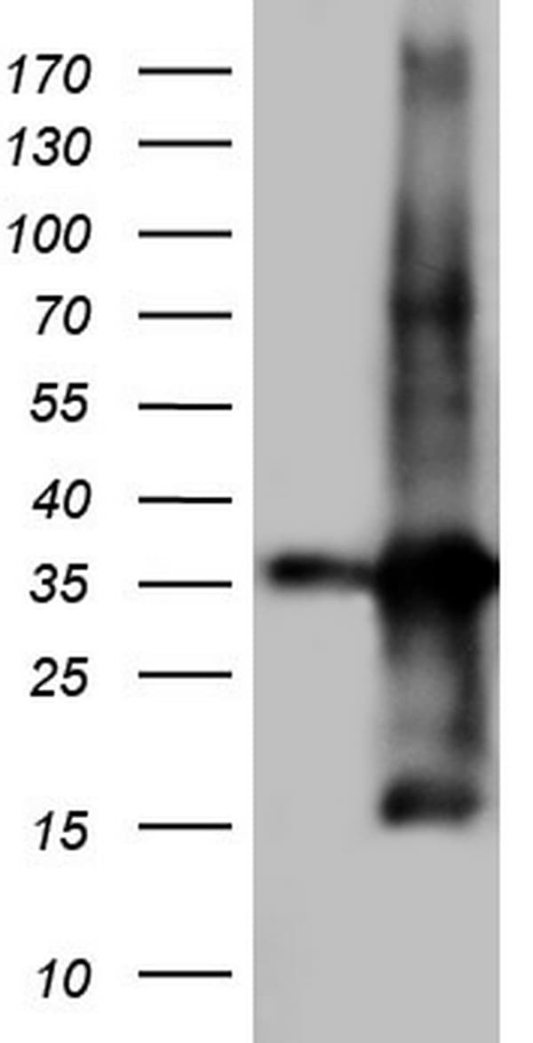 TACC2 Antibody (aa727-1026, clone OTI4D10)