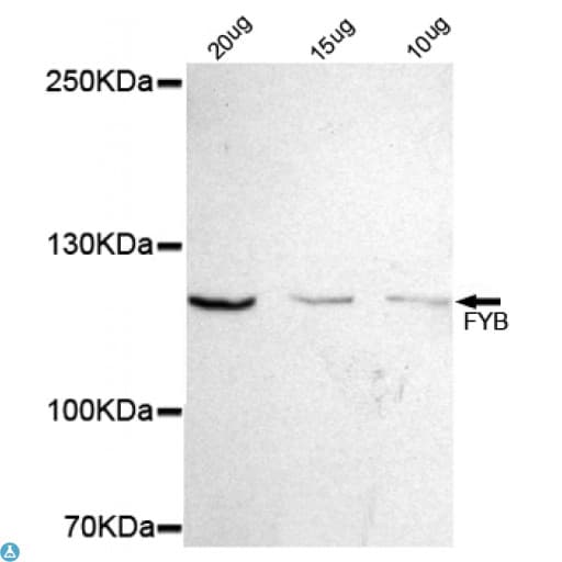 Monoclonal Mouse anti-Human ADAP / FYB Antibody (WB)