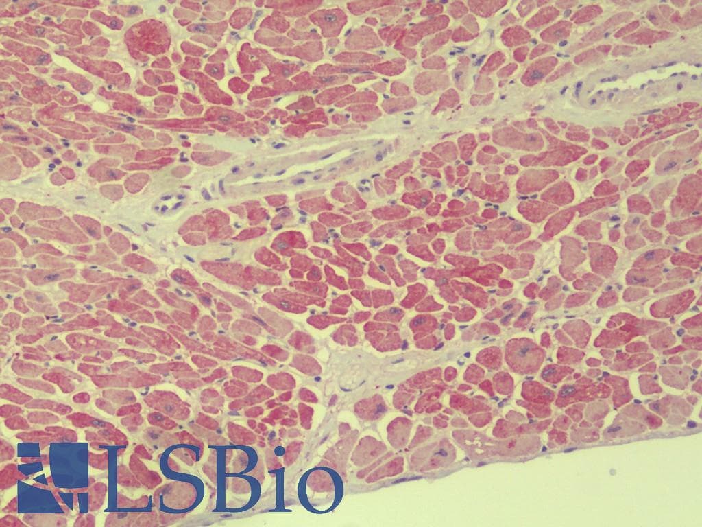 IHC-plus™ TMEM204 Antibody