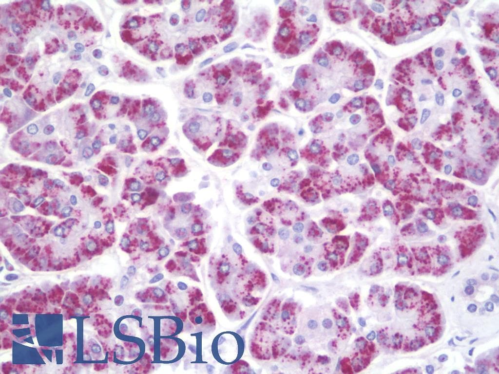 IHC-plus™ GGT1 / GGT Antibody (aa1-226)