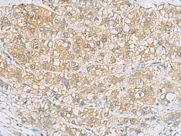EPCAM Antibody