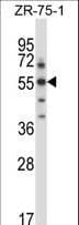 Polyclonal Rabbit anti-Mouse SGK3 Antibody (aa381-409, WB)