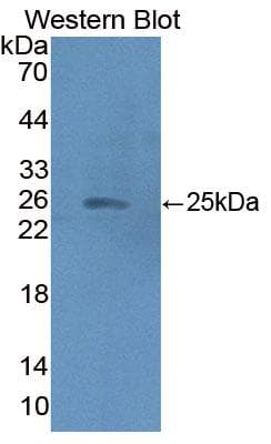 HMGCS2 / HMG-CoA Synthase 2 Antibody