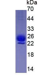 Human IL1RN Protein (Recombinant His, N-Terminal)