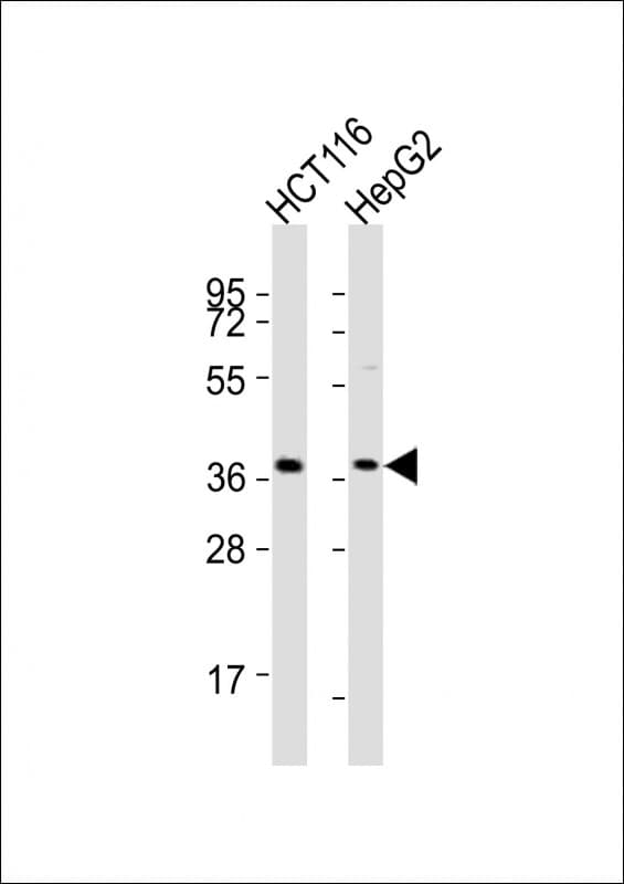 Polyclonal Rabbit anti-Human CTSL / Cathepsin L Antibody (aa97-129, WB)