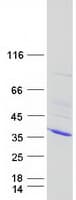 Human CDK2 Protein (Recombinant Myc-DDK (Flag))