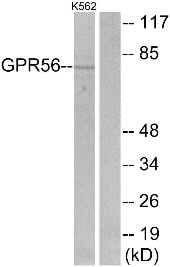 ADGRG1 / GPR56 Antibody