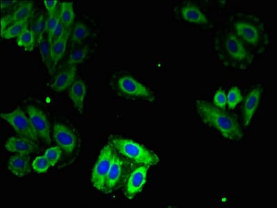 RYR1 / RYR Antibody (aa1-534)
