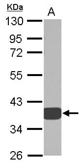 AKR1D1 Antibody