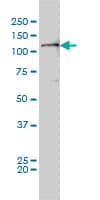 Monoclonal Mouse anti-Human FAK / Focal Adhesion Kinase Antibody (clone 2C3, WB)