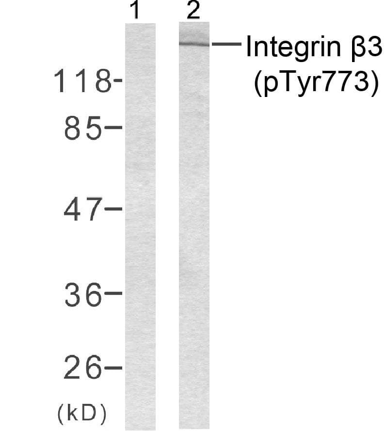 ITGB3 / Integrin Beta 3 / CD61 Antibody (phospho-Tyr773)