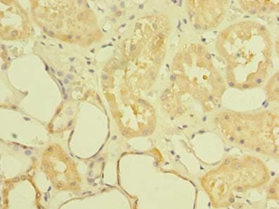 Polyclonal Rabbit anti-Human ST6GALNAC6 Antibody (IHC)