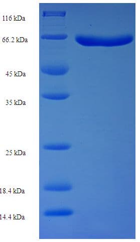 Schizosaccharomyces pombe hmt2 Protein (Recombinant His-SUMO)