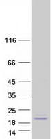 Human MRPS28 Protein (Recombinant Myc-DDK (Flag))