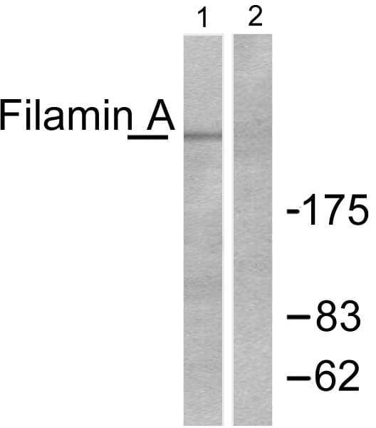 Polyclonal Rabbit anti-Human FLNA / Filamin A Antibody (p2152, WB)