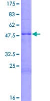 Human ARTN / Artemin Protein (Recombinant GST)