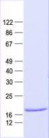 Human NME2 Protein (Recombinant His, N-Terminal)