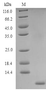 Human CD52 Protein (Recombinant 6His, N-terminus)