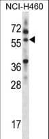 Polyclonal Rabbit anti-Human MINPP1 Antibody (aa370-398, WB)