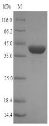 Hepatitis E Virus Capsid Protein VP1 (Recombinant 6His-SUMO, N-terminus)
