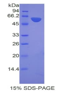 Mouse PHAP1 / ANP32A Protein (Recombinant His-GST)