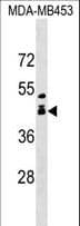 Polyclonal Rabbit anti-Human ALX1 Antibody (aa97-122, WB)