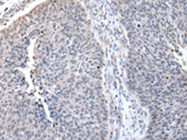 ZNF23 Antibody