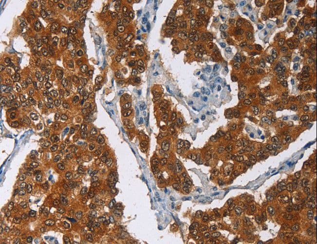 Polyclonal Rabbit anti-Human CRABP2 Antibody (IHC)
