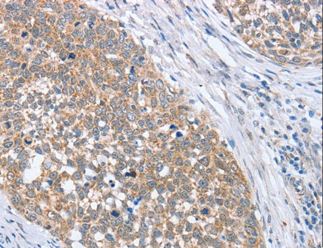 PAPSS 1 Antibody