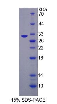 Mouse OS9 Protein (Recombinant His-T7, N-terminus)