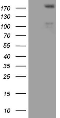 FLT4 / VEGFR3 Antibody (aa1063-1363, clone OTI1G7)