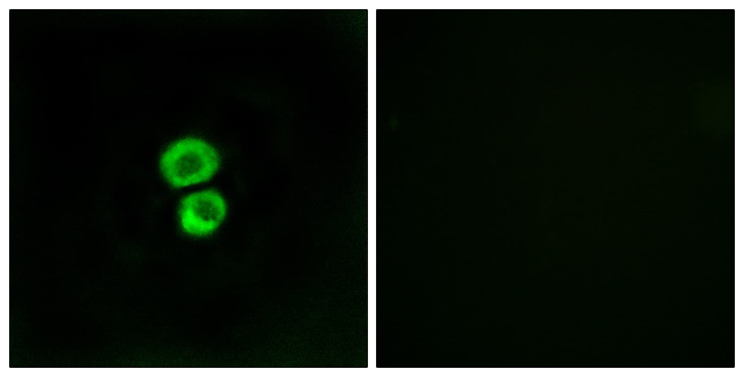 Polyclonal Rabbit anti-Human Fragilis / IFITM3 Antibody (aa1-50, IF, WB)
