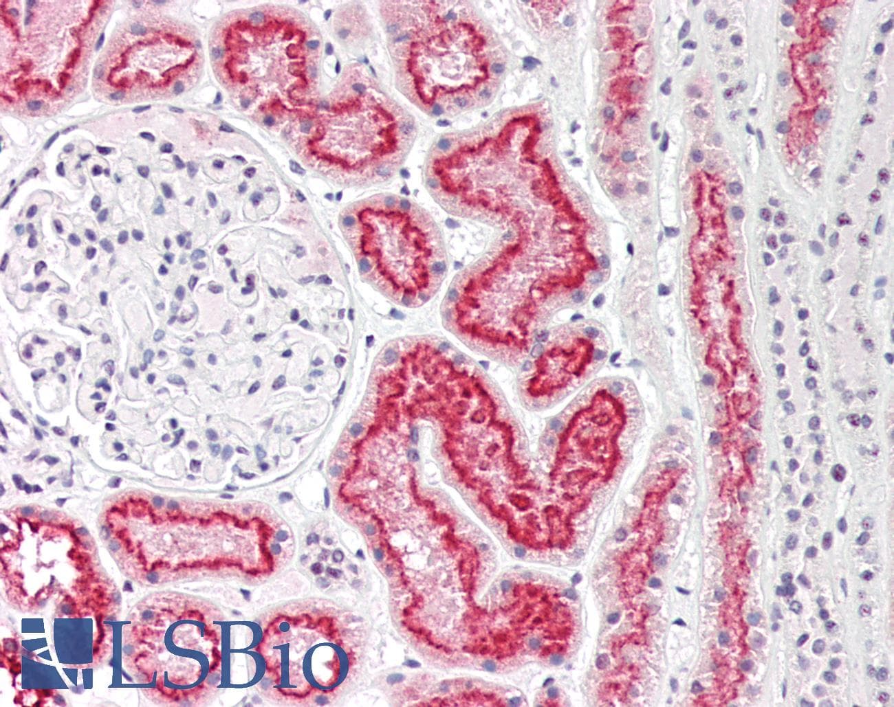 IHC-plus™ CUBN / Cubilin Antibody (N-Terminus)