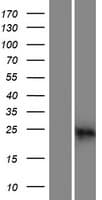 CABP2 Protein (Over-Expression Lysate Myc-DDK (Flag))