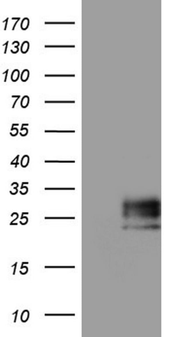 Monoclonal Mouse anti-Human Adiponectin Antibody (clone OTI6B8, aa19-244, IHC, WB)