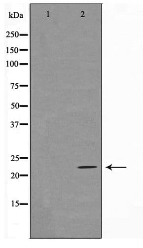 Polyclonal Rabbit anti-Human ASF1A Antibody (WB)