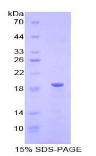 Mouse RLN1 / Relaxin Protein (Recombinant His)