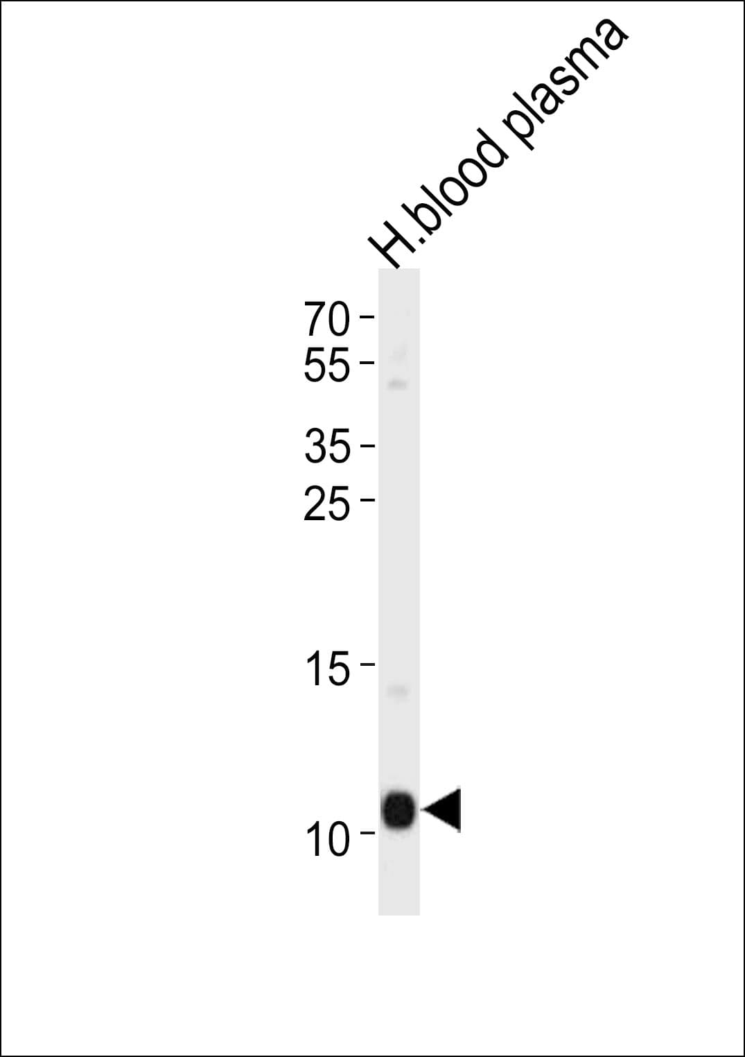 Polyclonal Rabbit anti-Human Apolipoprotein A-II Antibody (aa23-56, WB)
