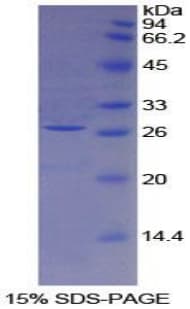 Mouse F3 / CD142 / Tissue factor Protein (Recombinant His, N-Terminal)