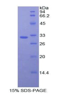 Mouse THPO / TPO / Thrombopoietin Protein (Recombinant His, N-Terminal)