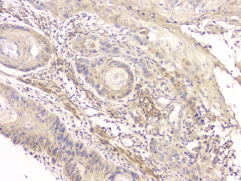 CCR10 / GPR2 Antibody