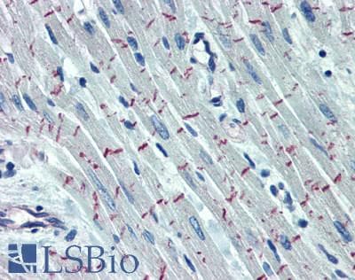 IHC-plus™ DSP / Desmoplakin Antibody (aa1900-1950)