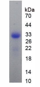 Mouse TNFRSF11A / RANK Protein (Recombinant His, N-Terminal)