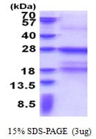 Human FcERI / Fc Epsilon RI Protein (Recombinant His)
