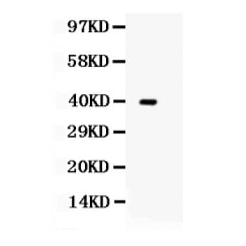 TRIB2 Antibody (aa175-211)